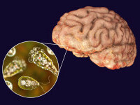 amiba care mănâncă creierul