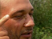 Mărturia unui bărbat care a fost atacat de urs când se întorcea de la cumpărături. „Mi-a dat cu laba peste față”