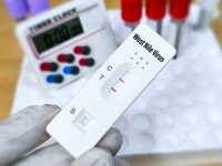Crește numărul de cazuri de infecții cu virusul West Nile. Autoritățile trag un semnal de alarmă