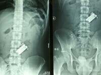 Gluma facuta la betie: i-au bagat telecomanda in anus!