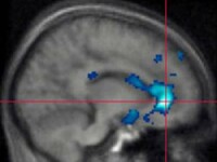 Violenta afecteaza structura creierului la adolescenti!