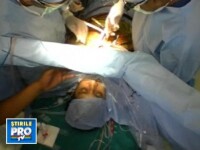 Uimitor! Operatie pe cord deschis, cu pacientul treaz tot timpul! VIDEO