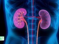 Cum putem preveni pietrele la rinichi și ce trebuie să facem în cazul în care apar