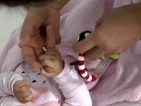 Miruna, fetița de șase luni din Galați, salvată cu o operație complicată pe creier. Ajunsese în comă la spitalul din Iași