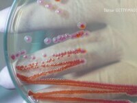 Lepra a reapărut în România după mai bine de 40 de ani. Noi detalii despre cele două cazuri confirmate în Cluj-Napoca