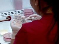 Decizia luată de medicii din Cluj-Napoca în cazul femeilor suspecte de lepră. Care este starea lor