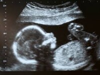 O britanica a primit o felicitare din partea clinicii unde a facut avort. Socul tinerei cand a vazut ce i-au scris angajatii