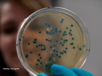 OMS a intocmit o lista a bacteriilor rezistente la antibiotice, care ameninta umanitatea. Care sunt acestea