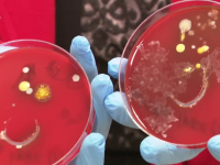 Alte două paciente infectate cu o bacterie periculoasă la Institutul ”Marius Nasta”