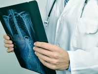 radiografie rinichi