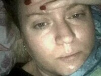 O femeie doarme 22 de ore pe zi și medicii nu i-au găsit leacul. Ce face ca să supraviețuiască în cele două ore rămase