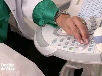 Nu există nicio metodă de a preveni cancerul de sân, dar depistarea precoce înseamnă rată de supraviețuire de 100%