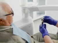 (P) Impactul osteoporozei asupra sănătății dentare și implanturilor: Ce trebuie să știți