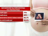 Bebelus nascut cu malformatii grave, in Bucuresti, desi medicii au urmarit sarcina. 