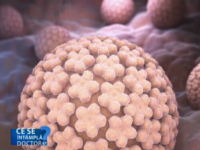 Metodele de prevenire a infectiilor cu HPV, virusul care poate cauza cancerul. Cel mai frecvent tip