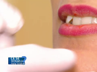 Buzele pot oferi primul semnal al unei boli grave. Când trebuie să mergi la medic