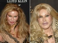 Jocelyn Wildenstein