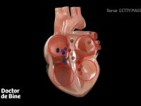 Ce putem face dacă avem palpitații. „Controlează inclusiv inima și vasele de sânge”