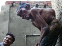 Omul cu chip de monstru! Doctorii: Este unic in lume