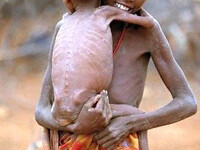 Catastrofa umanitara. Tara unde ONU declara foametea pentru prima oara in ultimii 30 de ani