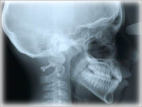 radiografie craniana