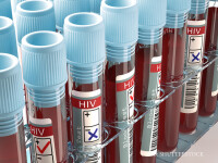 analize HIV