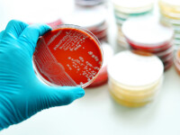 OMS avertizeaza asupra aparitiei unei superbacterii ce produce gonoree. Nu exista inca niciun tratament impotriva ei