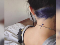 Cât de periculoase sunt bijuteriile montate sub piele. Avertismentul medicilor