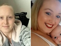 Coșmarul unei femei, diagnosticată greșit cu cancer. Și-a extirpat sânii