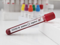 test negativ coronavirus