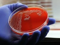 superbacterie