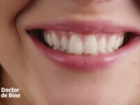 Inteligența artificială, aliatul medicilor stomatologi, pentru zâmbete perfecte. Generează modele 3D ale danturii