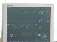 Două fetițe din Sibiu sunt în comă după ce au fost spălate de sora lor cu o soluție pentru deparazitarea oilor