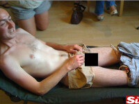 Epilatul inghinal era sa-l lase fara un testicul