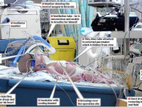 Incredibil! Bebelus inghetat de medici 4 zile, ca sa ii salveze viata