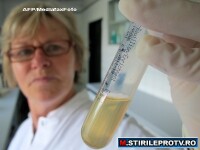 Inca un deces din cauza bacteriei E.coli. Germania: Numarul imbolnavirilor, in scadere