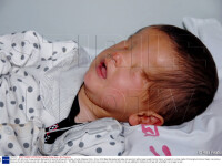 copil nascut fara ochi, China