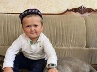 Un băiat cu o boală rară a devenit senzație pe Internet. Un medic spune de ce pare și copil, și adult în același timp