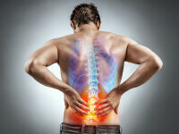 Cercetătorii americani au descoperit un leac pentru durerile de spate. Tratamentul este făcut din plastic