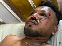 Un singur pasager a supraviețuit miraculos catastrofei aviatice din India. „Erau cadavre în jurul meu”