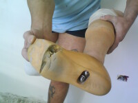 Coplesit de necazuri, un tanar din Onesti apeleaza la ajutorul vostru!