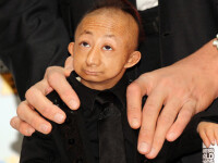 Cel mai mic om din lume a murit la numai 21 de ani