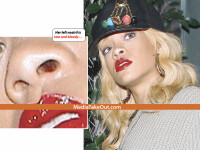 Ce ascunde Rihanna. Detaliul compromitator despre care scriu tabloidele. FOTO