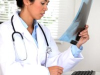 Faceti o radiografie de plamani o data pe an, indiferent daca fumati sau nu