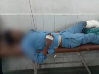 Imagini șocante, într-un spital din India. Un pacient doarme cu capul pe piciorul amputat
