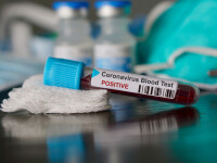 Cercetătorii chinezi au identificat două tipuri ale noului coronavirus