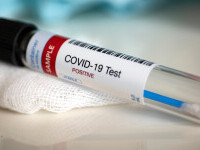 China aprobă utilizarea unui medicament împotriva HIV pentru tratarea pacienților bolnavi de COVID-19