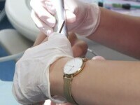 Control stomatologic