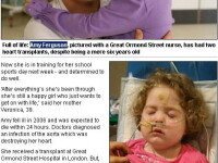 De necrezut! Ea este fetita cu trei inimi!