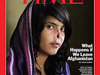 Cum arata dupa operatie Aesha, femeia careia i-a fost taiat nasul pentru ca a fugit de sotul ei